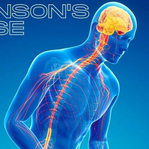 Parkinson